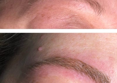 Microblading - A close up of a man - Microblading